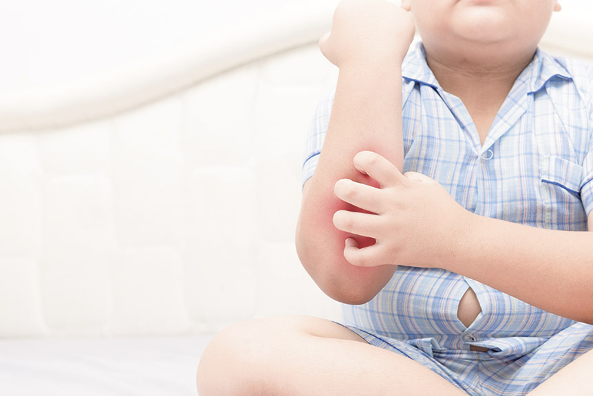 Kind kratzt sich am Arm. Thema: Atopische Dermatitis (Neurodermitis)
