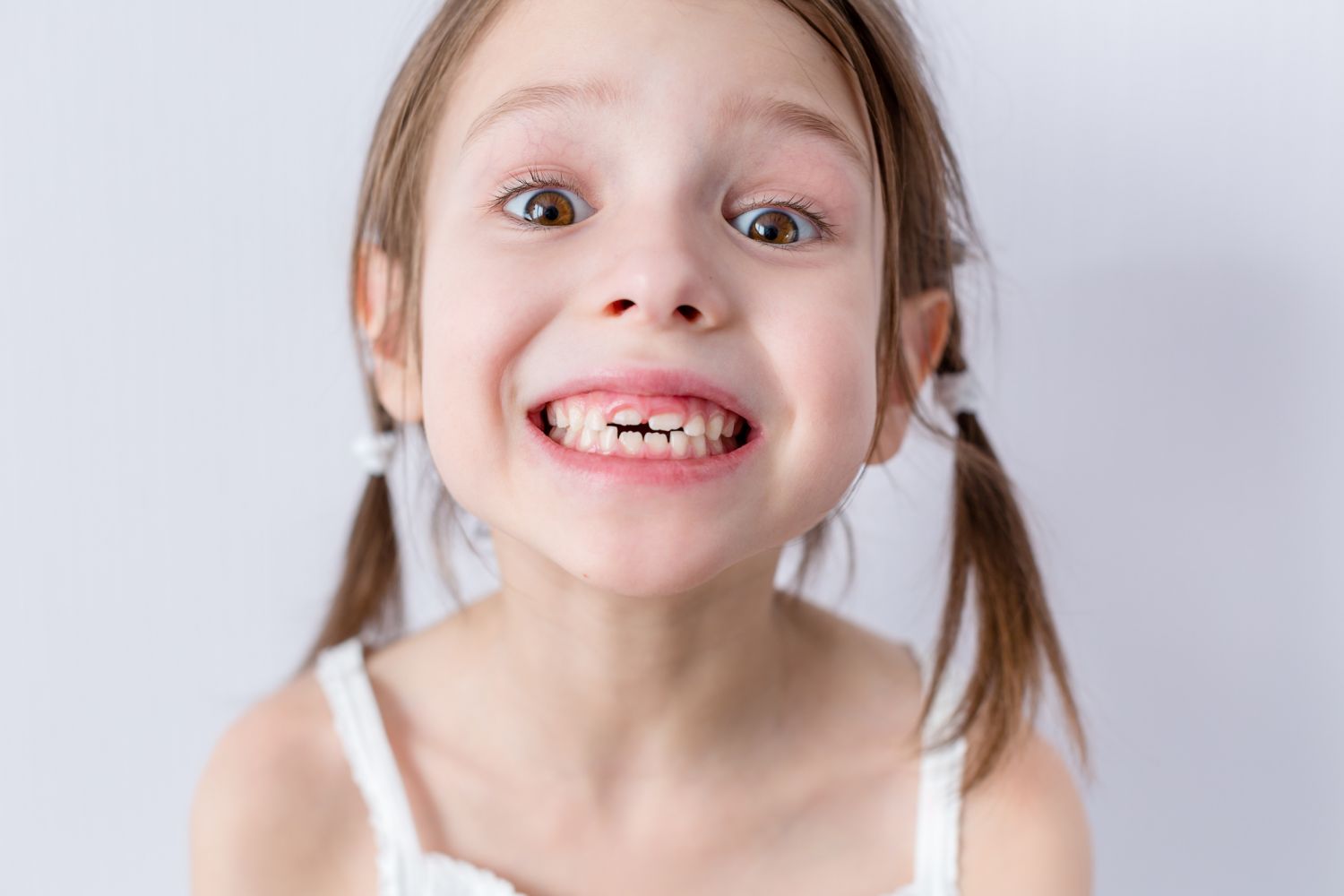 Ein Mädchen zeigt beim Lächeln seine Milchzähne. 