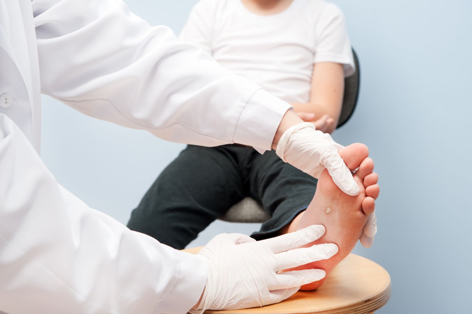  Ein Arzt deutet auf die Warze an der Fußsohle eines kleinen Jungen.